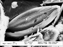 Anomoeoneis sphaerophora image